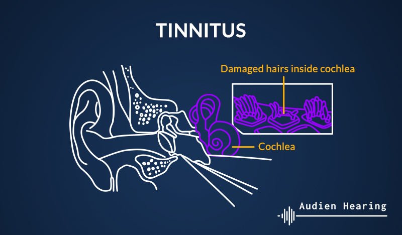 Diagram showing the inner ear and tinnitus