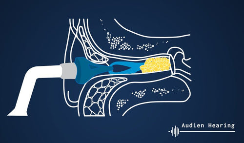 Diagram of the inner ear being cleaned out of earwax for tinnitus